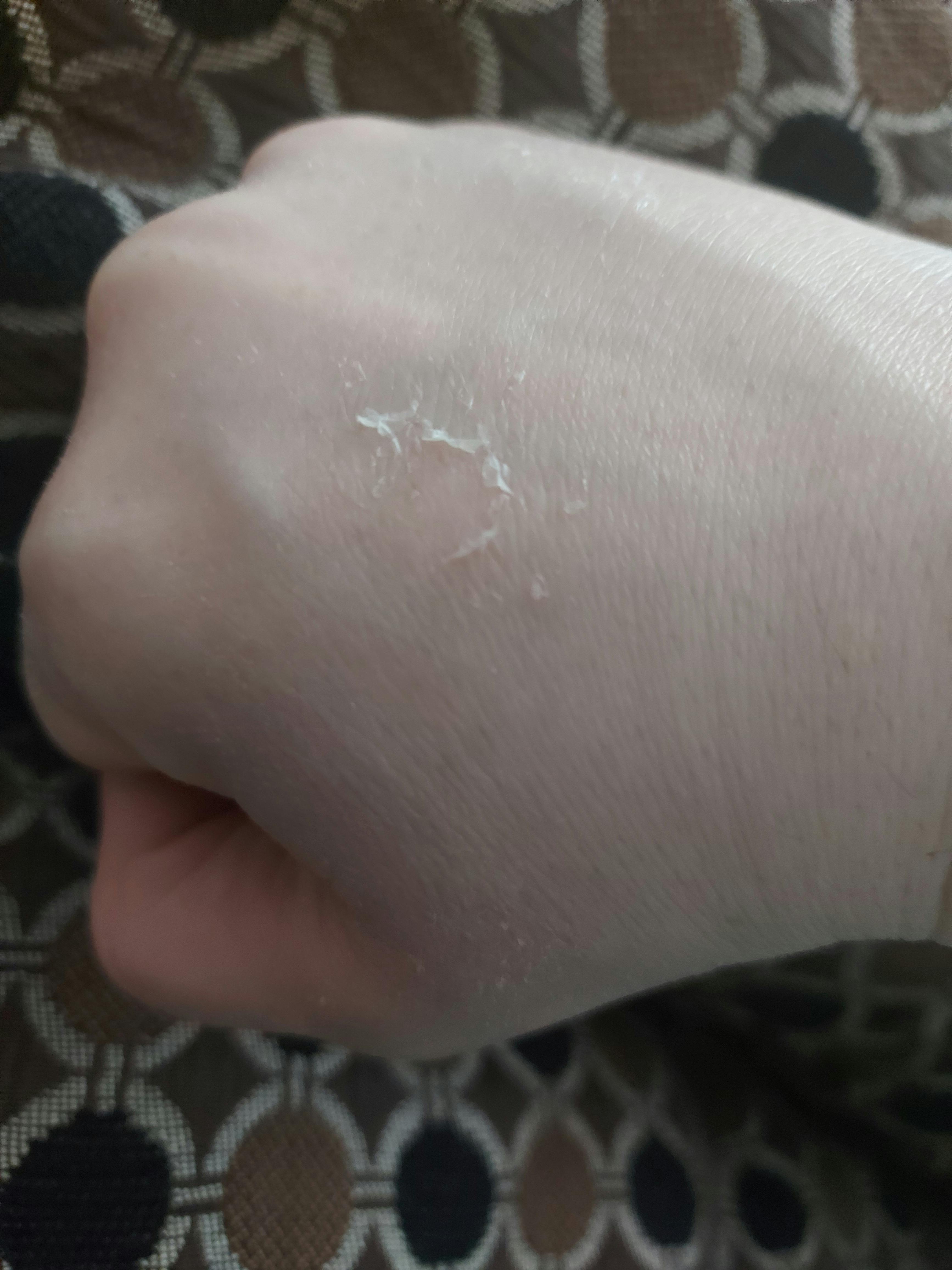 Platinum Skin Care Product Reviews